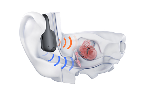 shokz-bone-conduct-visualisatie-geluidsweg-1.jpg